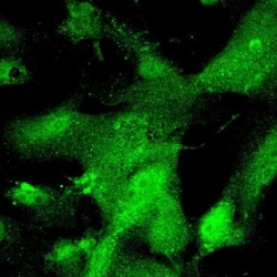 Claudin-1 Antibody - BSA Free, Novus Biologicals 0.1mg; Unlabeled:Antibodies,