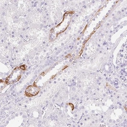 Claudin-16 Antibody, Novus Biologicals:Antibodies:Primary Antibodies