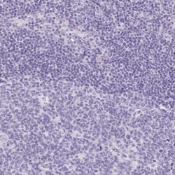 Claudin-16 Antibody, Novus Biologicals:Antibodies:Primary Antibodies