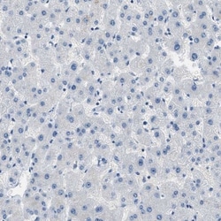 Claudin-18 Antibody, Novus Biologicals:Antibodies:Primary Antibodies