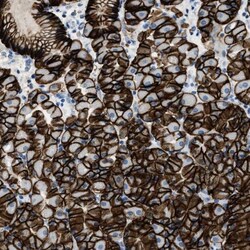 Claudin-18 Antibody, Novus Biologicals:Antibodies:Primary Antibodies
