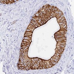 Claudin-8 Antibody, Novus Biologicals:Antibodies:Primary Antibodies
