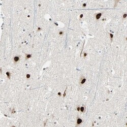 CoREST3/RCOR3 Antibody, Novus Biologicals 25 &mu;L | Buy Online | Novus Biologicals | Fisher Scientific