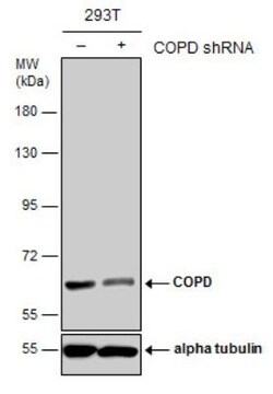 Coatomer Subunit Delta Antibody (189), Novus Biologicals 0.1mL; Unlabeled:Antibodies,