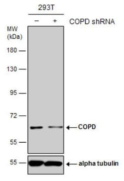 Coatomer Subunit Delta Antibody, Novus Biologicals 0.1mL; Unlabeled:Antibodies,
