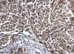 Coilin Antibody, Novus Biologicals 0.1mL; Unlabeled:Antibodies, Polyclonal