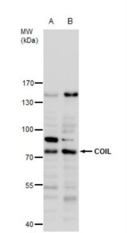 Coilin Antibody, Novus Biologicals 0.1mL; Unlabeled:Antibodies, Polyclonal