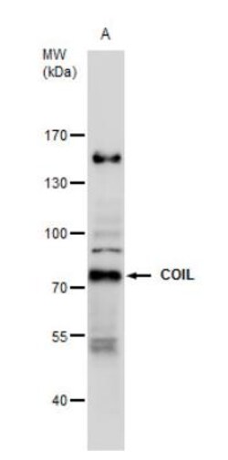 Coilin Antibody, Novus Biologicals 0.1mL; Unlabeled:Antibodies, Polyclonal