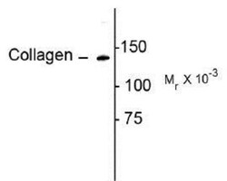 Collagen I alpha 1 Antibody - Azide and BSA Free, Novus Biologicals 0.02mL:Antibodies,