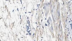Collagen III alpha 1/COL3A1 Antibody (1E7-D7/Col3) - BSA Free, Novus Biologicals:Antibodies:Primary