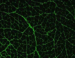 Collagen III alpha 1/COL3A1 Antibody, Novus Biologicals 0.1mg; Unlabeled:Antibodies,