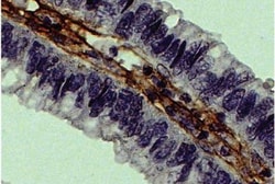 Collagen III alpha 1/COL3A1 Antibody, Novus Biologicals 0.1mg; Unlabeled:Antibodies,