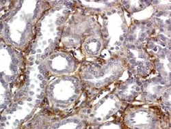 Collagen III alpha 1/COL3A1 Antibody, Novus Biologicals 0.1mg; Unlabeled:Antibodies,