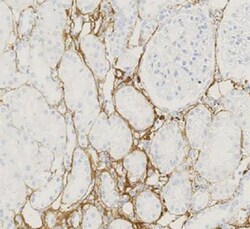 Collagen III alpha 1/COL3A1 Antibody, Novus Biologicals 0.1mg; Unlabeled:Antibodies,