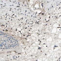 Collagen III alpha 1/COL3A1 Antibody, Novus Biologicals 0.1mL; Unlabeled:Antibodies,