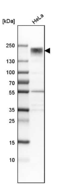 Collagen III alpha 1/COL3A1 Antibody, Novus Biologicals 0.1mL; Unlabeled:Antibodies,