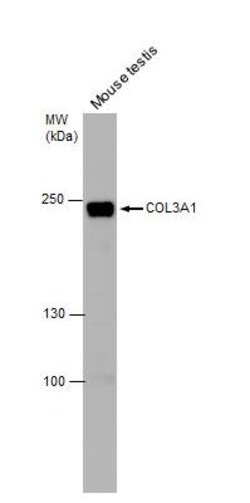 Collagen III alpha 1/COL3A1 Antibody, Novus Biologicals 0.1mL; Unlabeled:Antibodies,