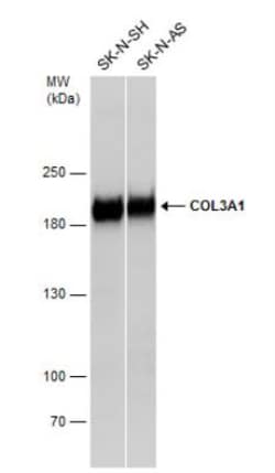 Collagen III alpha 1/COL3A1 Antibody, Novus Biologicals 0.1mL; Unlabeled:Antibodies,