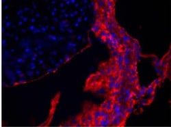 Collagen V Antibody, Novus Biologicals 0.1mg; Unlabeled:Antibodies, Polyclonal