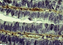Collagen V Antibody, Novus Biologicals 0.1mg; Unlabeled:Antibodies, Polyclonal