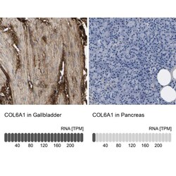Collagen VI alpha 1 Antibody, Novus Biologicals 25 &mu;L | Buy Online | Novus Biologicals | Fisher Scientific