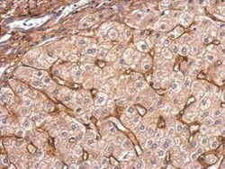 Collagen VI alpha 1 Antibody, Novus Biologicals 0.1mL; Unlabeled:Antibodies,