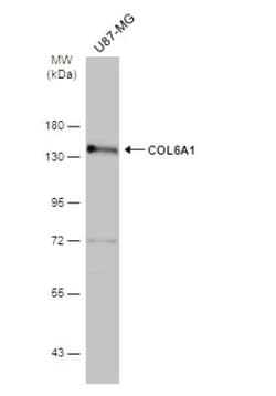 Collagen VI alpha 1 Antibody, Novus Biologicals 0.1mL; Unlabeled:Antibodies,