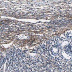 Collagen VI alpha 3 Antibody, Novus Biologicals 0.1mL; Unlabeled:Antibodies,