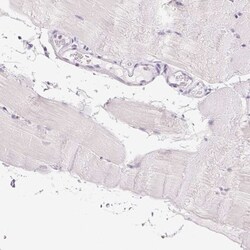Collagen VII Antibody, Novus Biologicals:Antibodies:Primary Antibodies