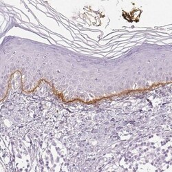 Collagen VII Antibody, Novus Biologicals:Antibodies:Primary Antibodies
