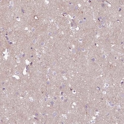 Collagen VIII alpha 1 Antibody, Novus Biologicals 0.1mL; Unlabeled:Antibodies,