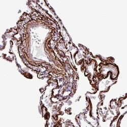 Collagen VIII alpha 1 Antibody, Novus Biologicals 0.1mL; Unlabeled:Antibodies,