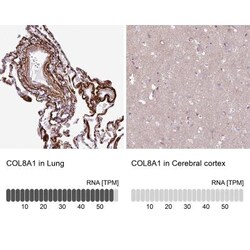 Collagen VIII alpha 1 Antibody, Novus Biologicals 0.1mL; Unlabeled:Antibodies,