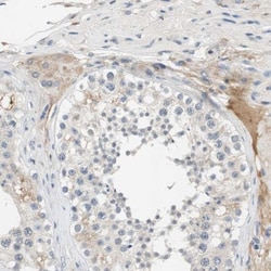 Collagen XII alpha1 Antibody, Novus Biologicals 0.1mL; Unlabeled:Antibodies,