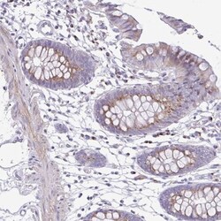 Collagen XVII Antibody, Novus Biologicals:Antibodies:Primary Antibodies