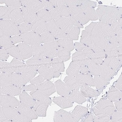 Collagen XVII Antibody, Novus Biologicals 25 &mu;L, Unconjugated:Antibodies,