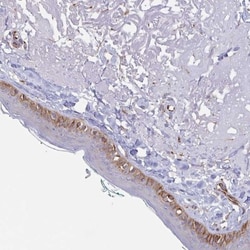 Collagen XVII Antibody, Novus Biologicals 25 &mu;L, Unconjugated:Antibodies,