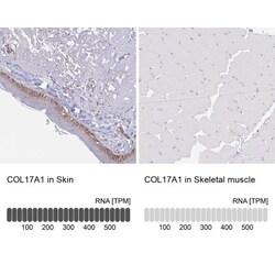 Collagen XVII Antibody, Novus Biologicals 25 &mu;L, Unconjugated:Antibodies,