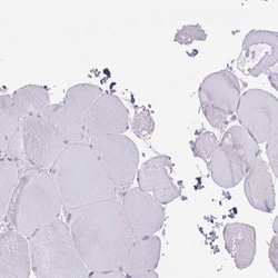 Collagen XVII Antibody, Novus Biologicals:Antibodies:Primary Antibodies
