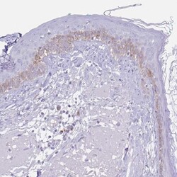 Collagen XVII Antibody, Novus Biologicals:Antibodies:Primary Antibodies