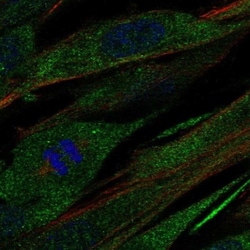 Collagen XXI Antibody, Novus Biologicals:Antibodies:Primary Antibodies
