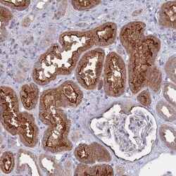 Collectrin/TMEM27 Antibody, Novus Biologicals 25 &mu;L, Unlabeled:Antibodies,