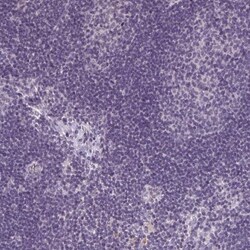 Collectrin/TMEM27 Antibody, Novus Biologicals 25 &mu;L, Unlabeled:Antibodies,