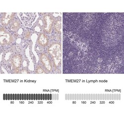 Collectrin/TMEM27 Antibody, Novus Biologicals 25 &mu;L, Unlabeled:Antibodies,