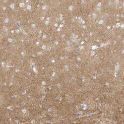 Collybistin/ARHGEF9 Antibody, Novus Biologicals:Antibodies:Primary Antibodies