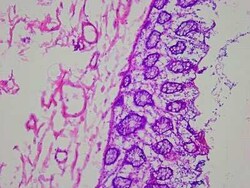 Novus Biologicals Colon Matched Tumor and Normal Tissue Slides (Tumor)- Frozen 10 Slides | Buy Online | Novus Biologicals&trade; | Fisher Scientific