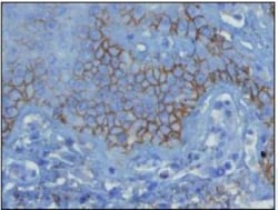 Rabbit anti-Complement C3d, Clone: E28-P, Novus Biologicals 100&mu;L; Unlabeled:Antibodies,