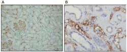 Rabbit anti-Complement C4, Clone: A24-T, Novus Biologicals 100&mu;L; Unlabeled:Antibodies,