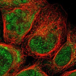 Complement Component C1r Antibody, Novus Biologicals 0.1mL; Unlabeled:Antibodies,