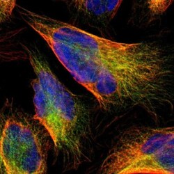 Complement Component C1rLP Antibody, Novus Biologicals 0.1mL; Unlabeled:Antibodies,